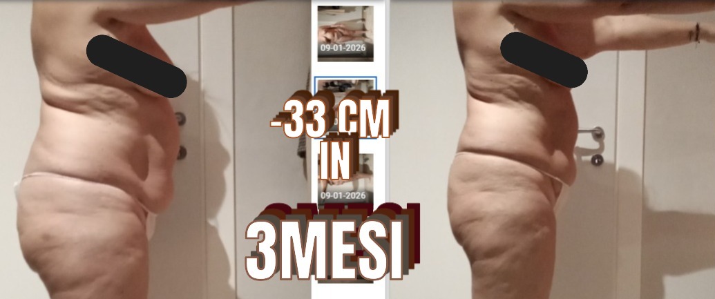 Risultato prima e dopo di Elena: −33 cm in 3 mesi con il protocollo NEW SKIN