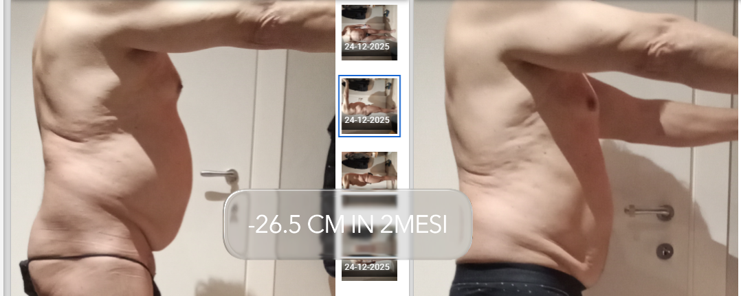 Risultato prima e dopo di Cliente Salèst: −26,5 cm in 2 mesi con il protocollo NEW SKIN