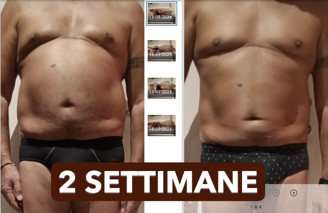 Risultato prima e dopo di Franco: Cambiamento in 2 settimane con il protocollo NEW SKIN
