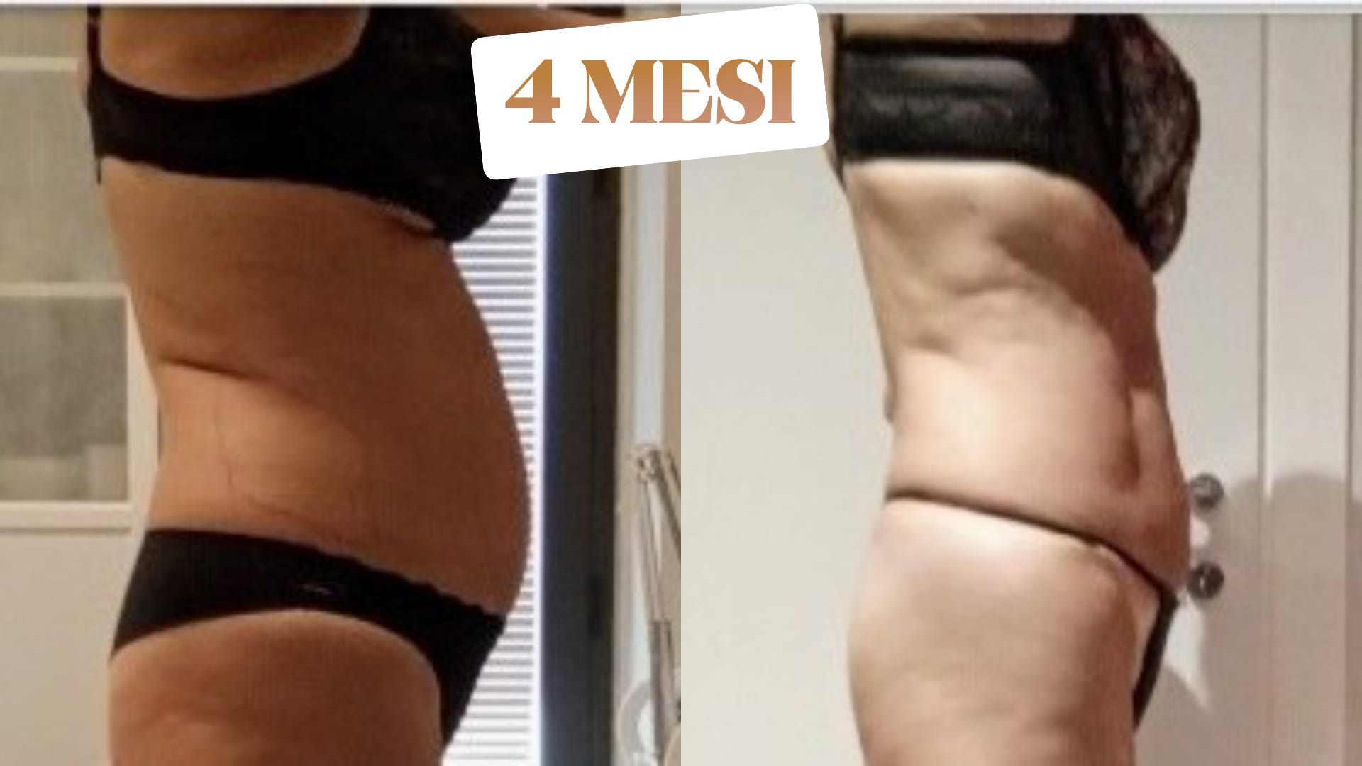 Risultato prima e dopo di Caterina: Trasformazione in 4 mesi con il protocollo NEW SKIN